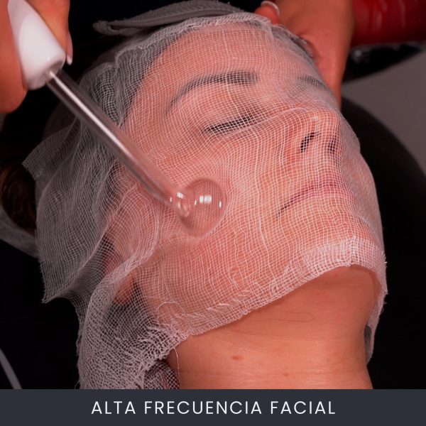 Alta Frecuencia Facial Alta Frecuencia Facial