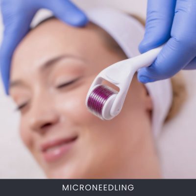 Microneedling