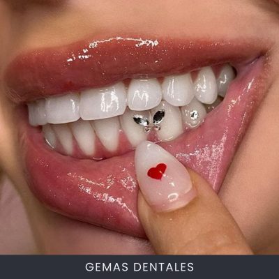 Gemas Dentales