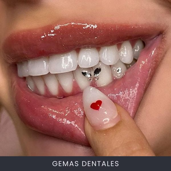 Gemas Dentales
