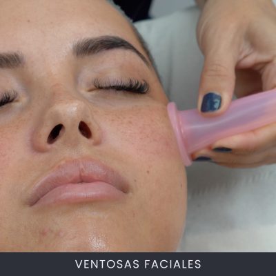 Ventosas Faciales