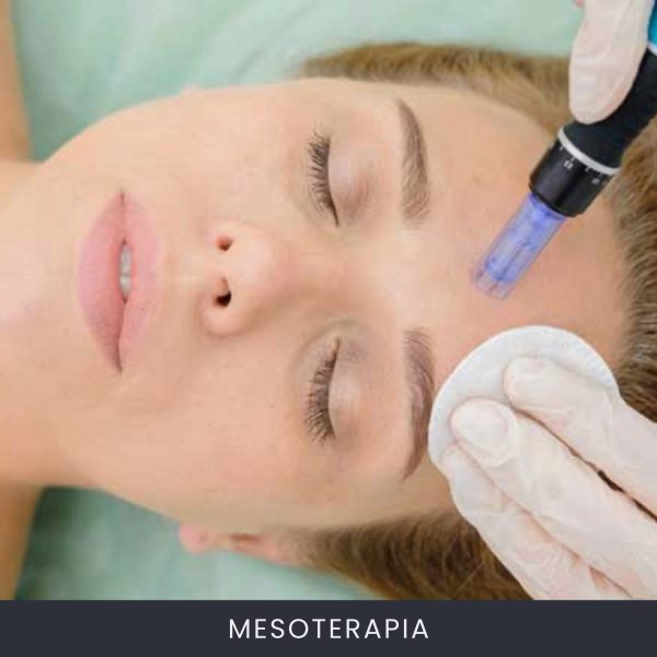 Mesoterapia